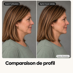 Bande Visage – LiftMyFace™